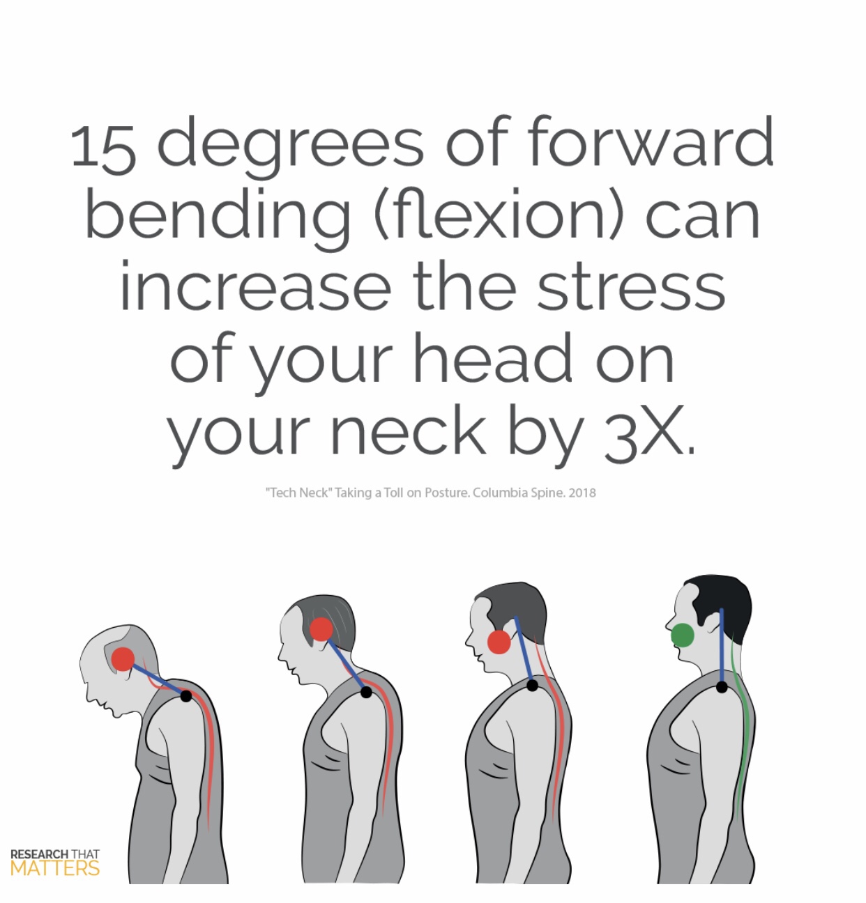 Graphic showing Forward Head Posture